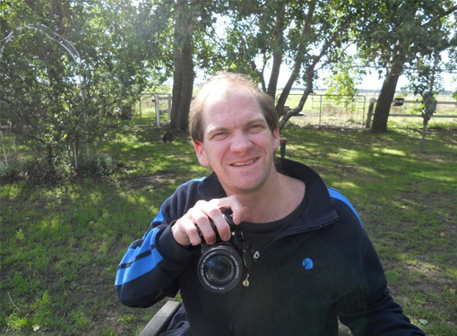 Fragile X Syndrome 12